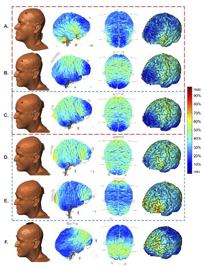 Slide from Marom Bikson's 2011 tDCS Lecture