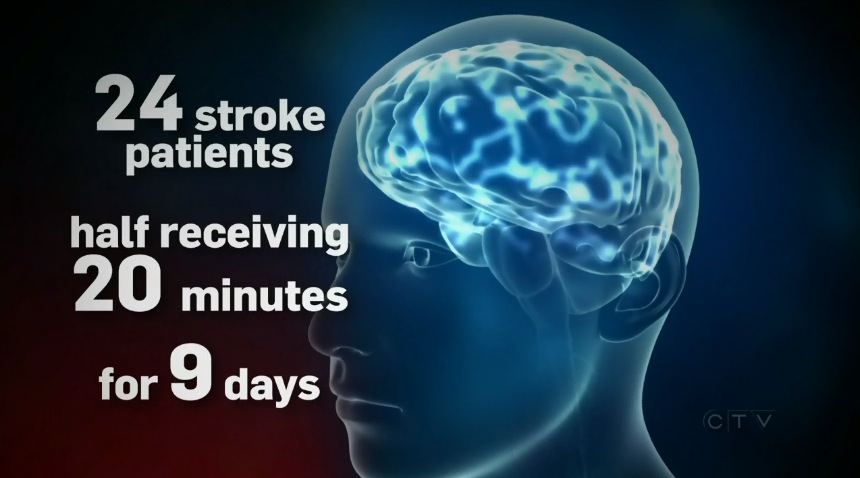 tdcsCtvStrokeStudy