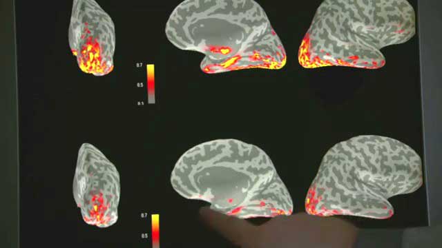 fMRI Showing Medial Temporal Lobe Activity