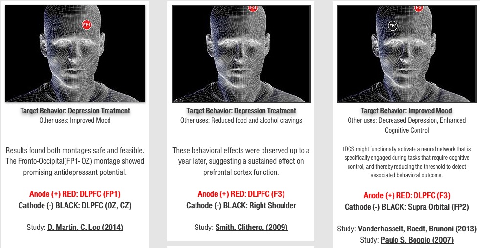 Tdcs Placement Chart