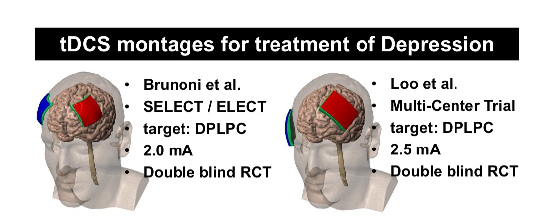 Tdcs Placement Chart